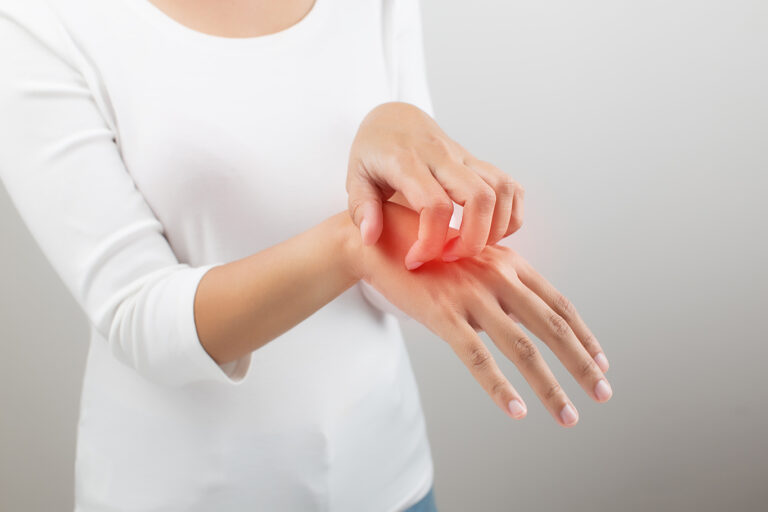 Atopische Dermatitis – «Juckreiz-Kratz-Zirkel» interdisziplinär betrachten und multimodal behandeln