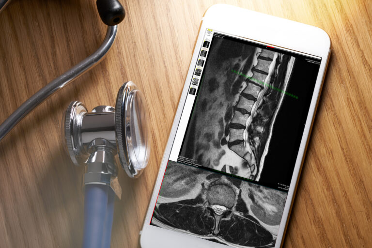 Biologika vor oder nach NSAR?