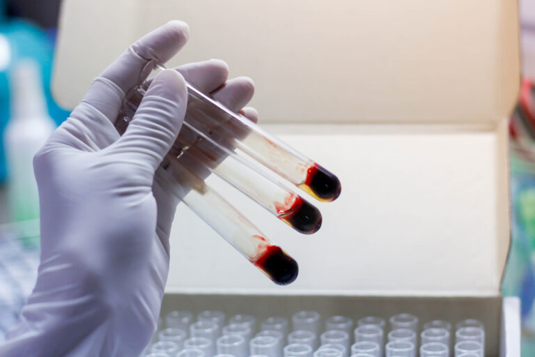 Die Welt der hämatologischen und onkologischen Forschung