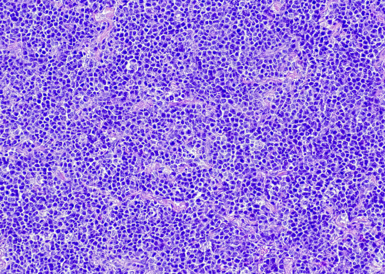 Hautgerichtete oder systemische Therapie?