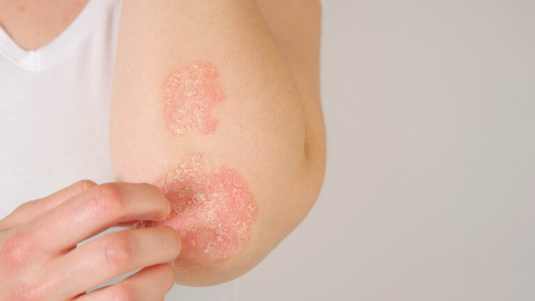Diagnose und Behandlung – ein praxisorientiertes Update