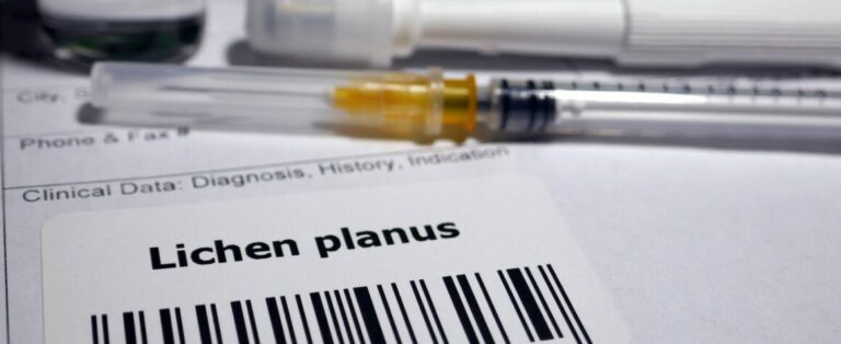 Behandlungsmöglichkeiten für schwere Fälle: Blick über den Tellerrand