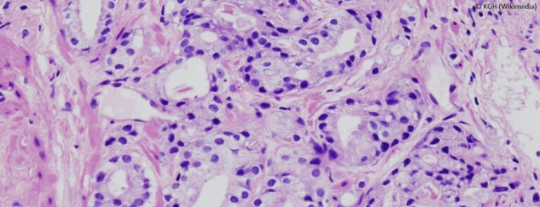 Von organbegrenzten Therapien sowie der personalisierten Medizin